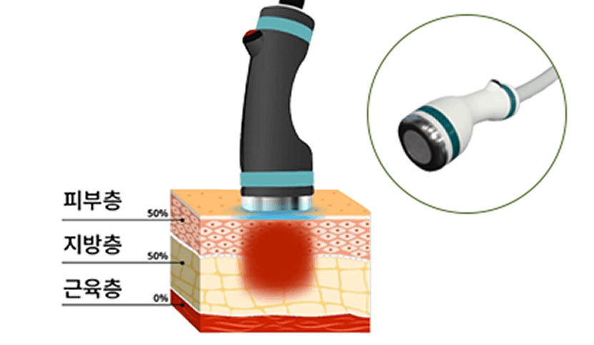 7mm 핸드피스 원리