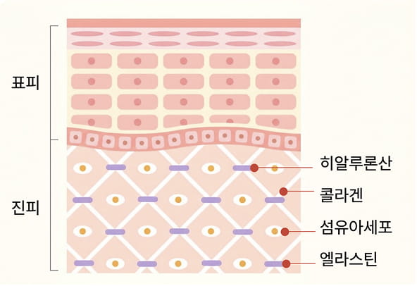 진피 환경 재건