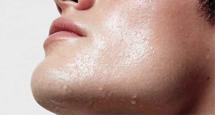 피부 토양의 환경 설계